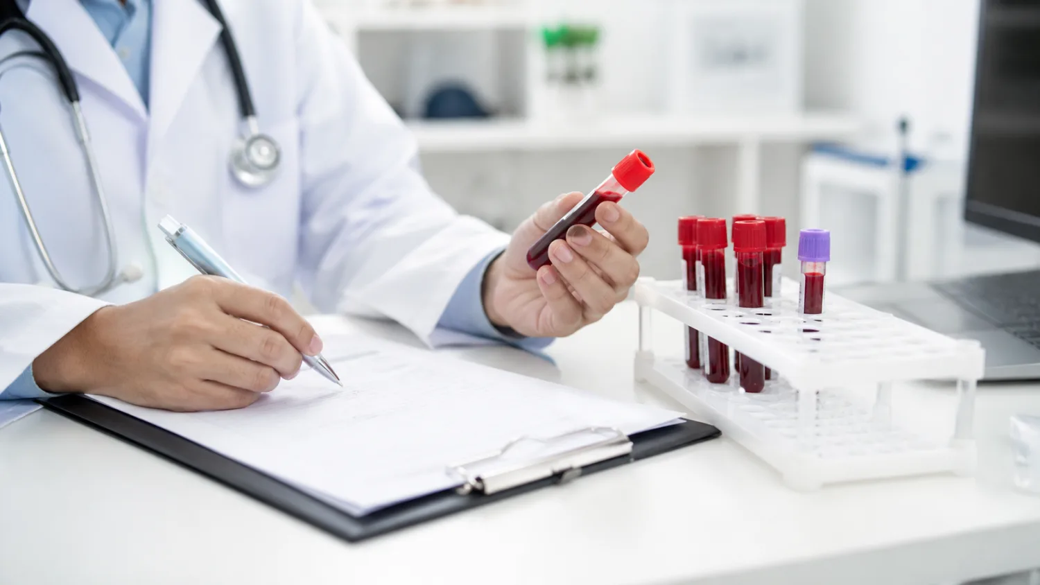 B12 and Folate Blood Test Results Explained