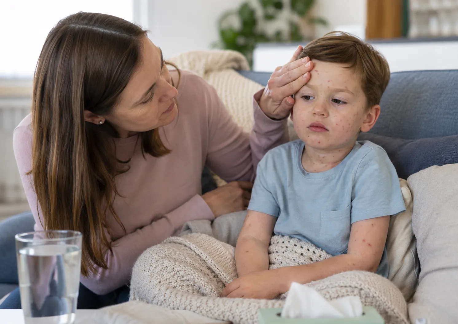 Chickenpox in Adults and Children: Symptoms, Rash, Treatment and When to Get Help